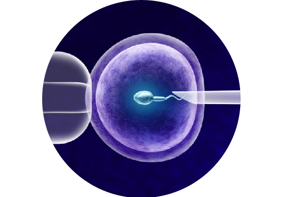 Laser Assisted Hatching